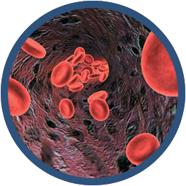 Anemia microcitica