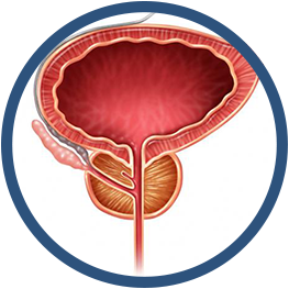 Proceso de prostata