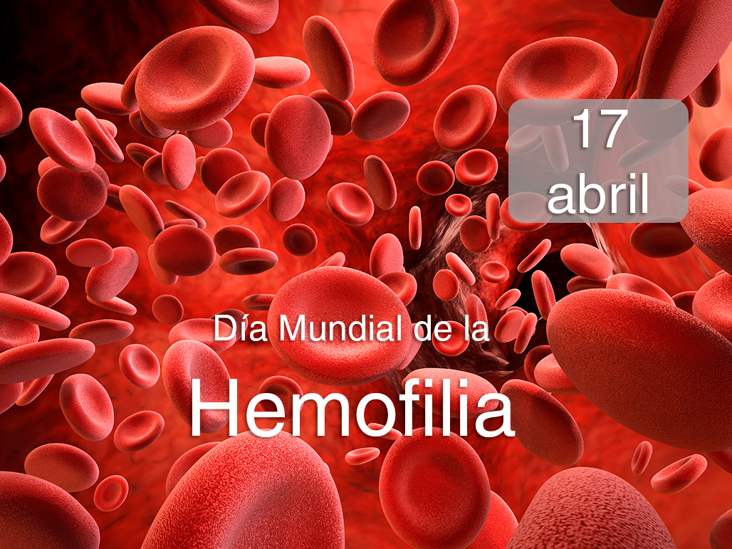 Hemofilia_imagendestacada