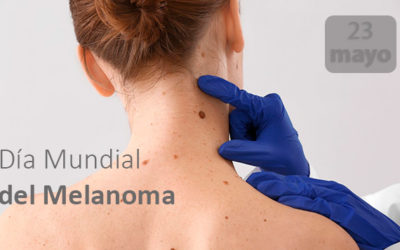 Día Mundial del Melanoma