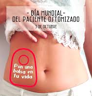 Día Mundial de los Pacientes Ostimizados